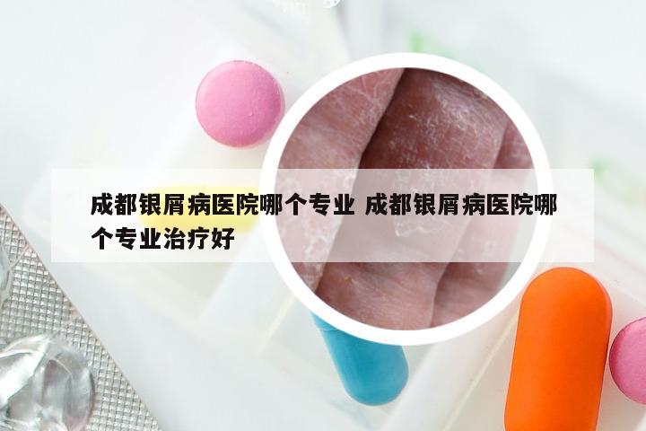 成都银屑病医院哪个专业 成都银屑病医院哪个专业治疗好