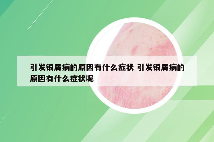 引发银屑病的原因有什么症状 引发银屑病的原因有什么症状呢