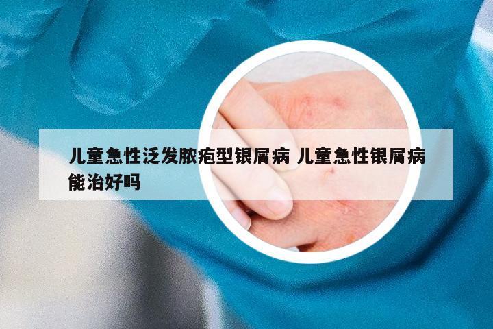 儿童急性泛发脓疱型银屑病 儿童急性银屑病能治好吗