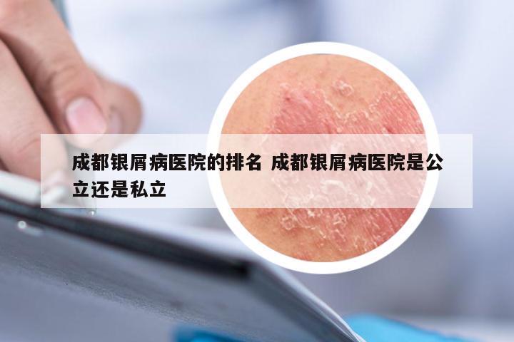 成都银屑病医院的排名 成都银屑病医院是公立还是私立