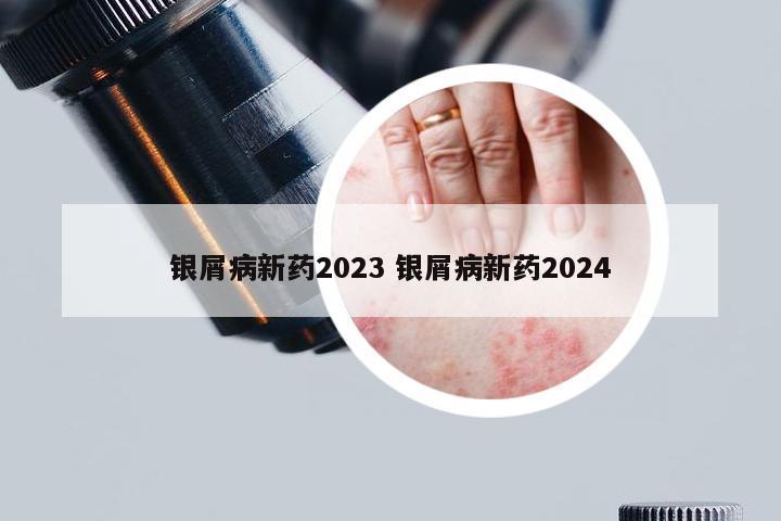 银屑病新药2023 银屑病新药2024