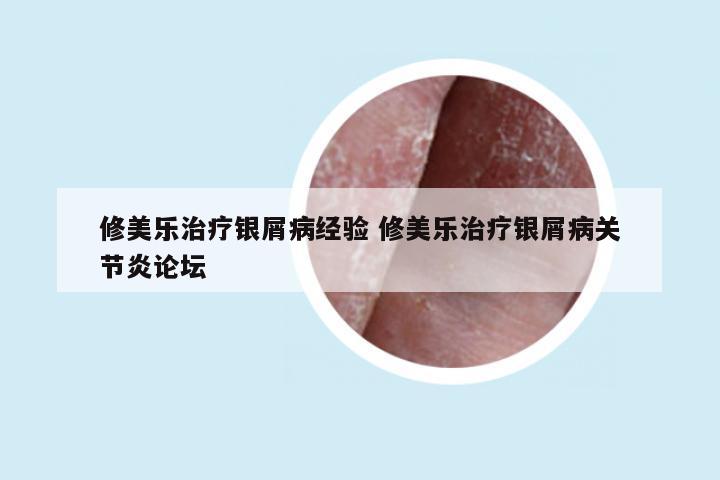 修美乐治疗银屑病经验 修美乐治疗银屑病关节炎论坛