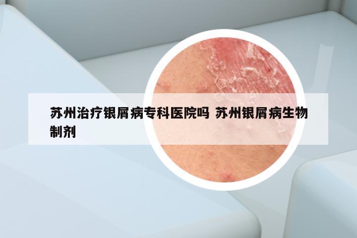 苏州治疗银屑病专科医院吗 苏州银屑病生物制剂