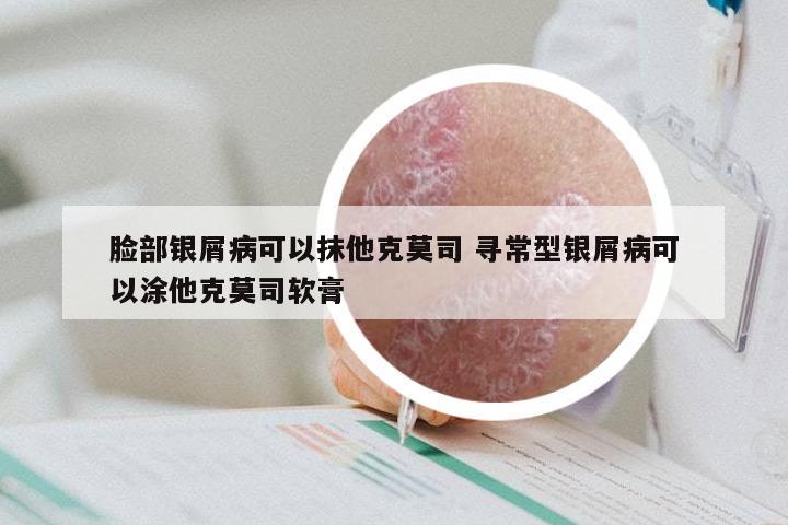 脸部银屑病可以抹他克莫司 寻常型银屑病可以涂他克莫司软膏