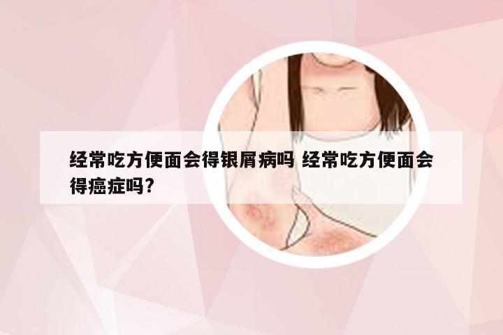 经常吃方便面会得银屑病吗 经常吃方便面会得癌症吗?