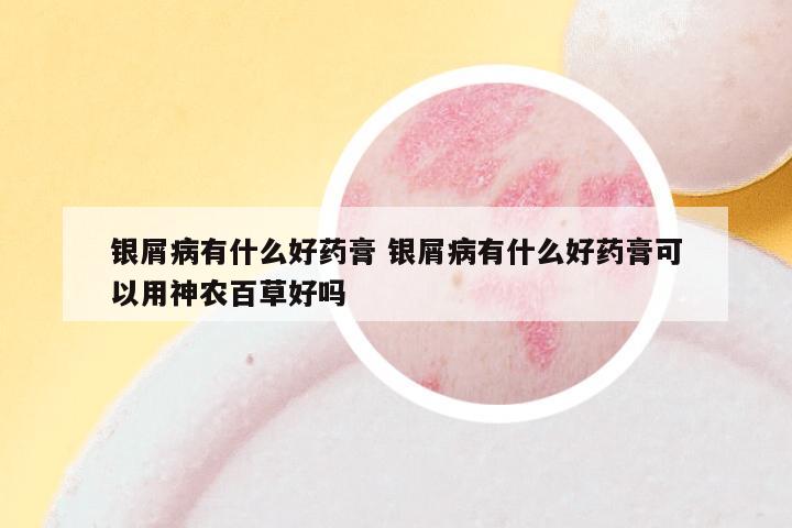 银屑病有什么好药膏 银屑病有什么好药膏可以用神农百草好吗