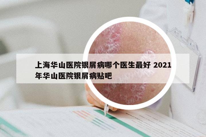 上海华山医院银屑病哪个医生最好 2021年华山医院银屑病贴吧