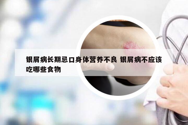 银屑病长期忌口身体营养不良 银屑病不应该吃哪些食物