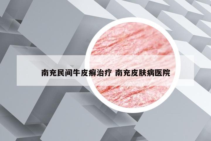 南充民间牛皮癣治疗 南充皮肤病医院