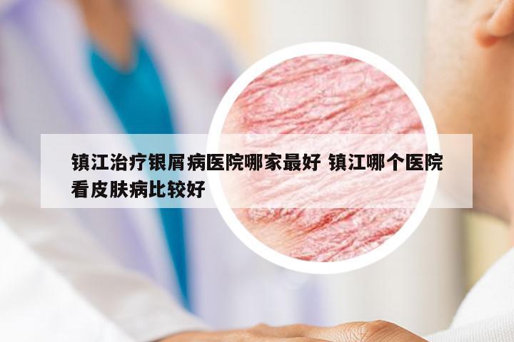 镇江治疗银屑病医院哪家最好 镇江哪个医院看皮肤病比较好