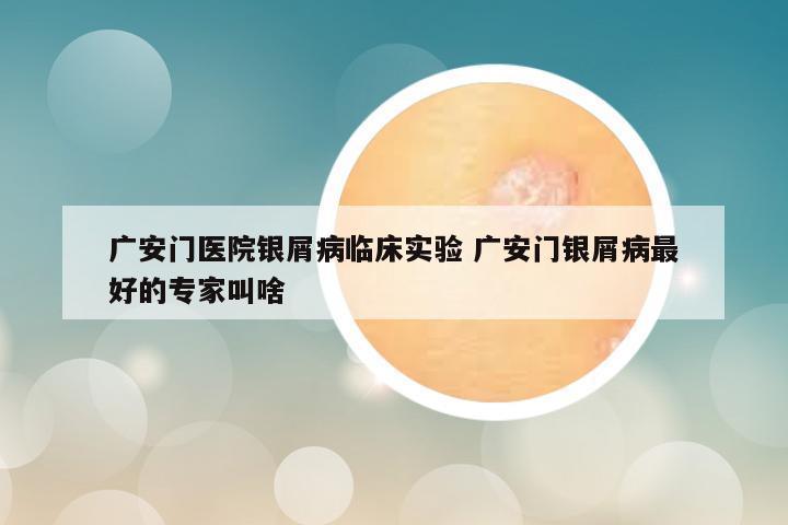 广安门医院银屑病临床实验 广安门银屑病最好的专家叫啥