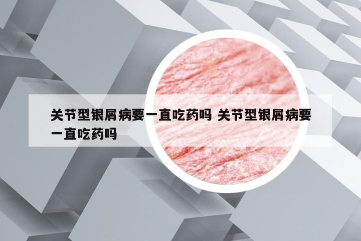 关节型银屑病要一直吃药吗 关节型银屑病要一直吃药吗