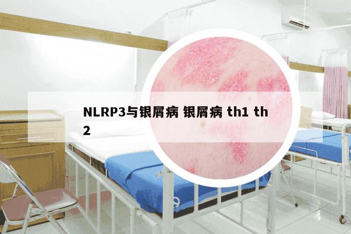 NLRP3与银屑病 银屑病 th1 th2