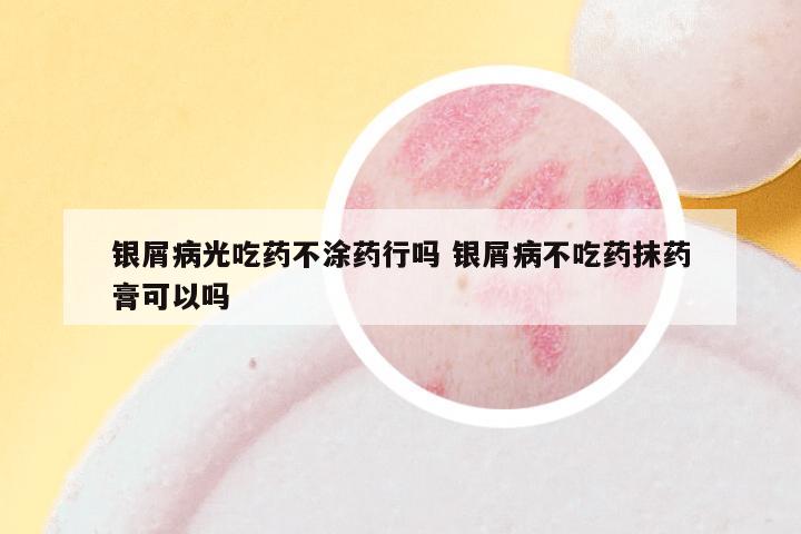 银屑病光吃药不涂药行吗 银屑病不吃药抹药膏可以吗