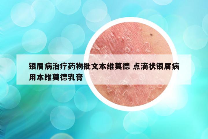 银屑病治疗药物批文本维莫德 点滴状银屑病用本维莫德乳膏