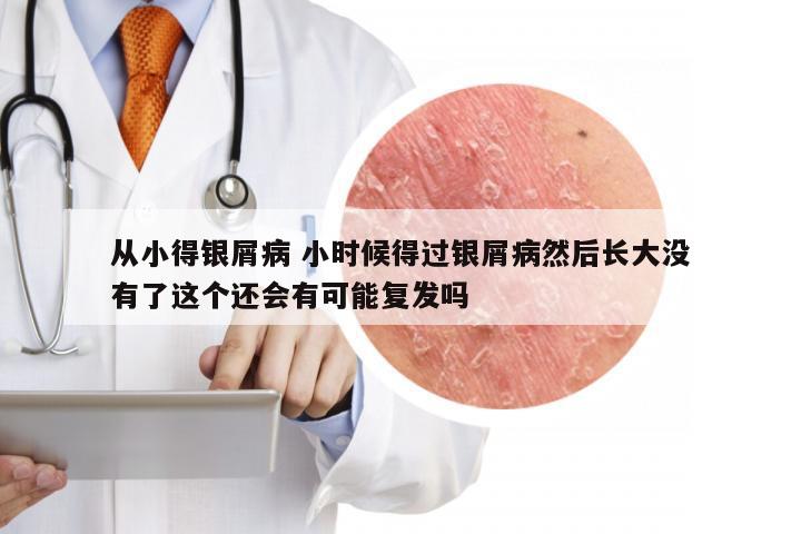 从小得银屑病 小时候得过银屑病然后长大没有了这个还会有可能复发吗