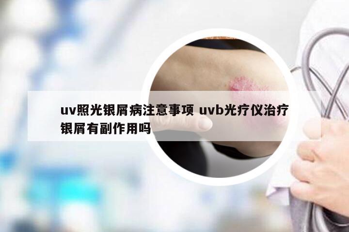 uv照光银屑病注意事项 uvb光疗仪治疗银屑有副作用吗