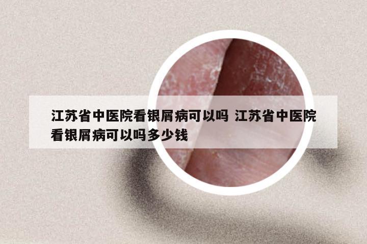 江苏省中医院看银屑病可以吗 江苏省中医院看银屑病可以吗多少钱