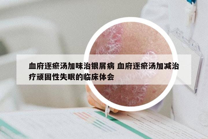 血府逐瘀汤加味治银屑病 血府逐瘀汤加减治疗顽固性失眠的临床体会