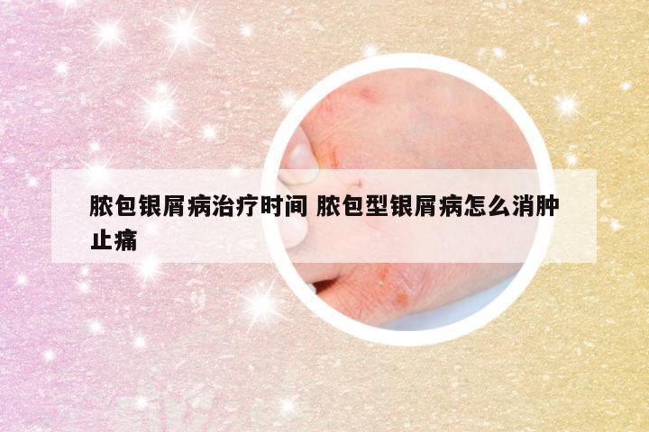 脓包银屑病治疗时间 脓包型银屑病怎么消肿止痛