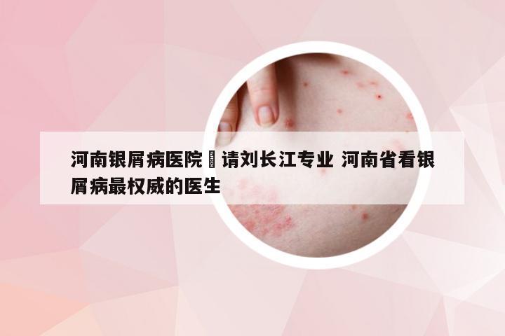 河南银屑病医院來请刘长江专业 河南省看银屑病最权威的医生