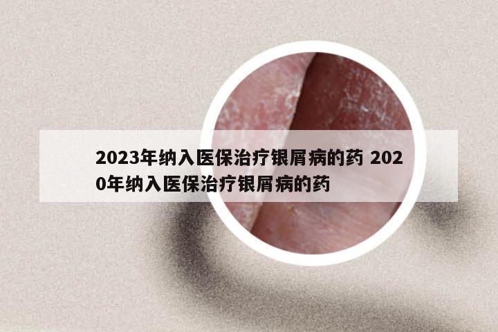 2023年纳入医保治疗银屑病的药 2020年纳入医保治疗银屑病的药