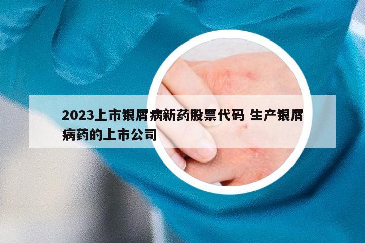 2023上市银屑病新药股票代码 生产银屑病药的上市公司