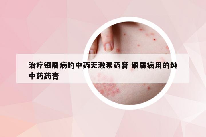 治疗银屑病的中药无激素药膏 银屑病用的纯中药药膏