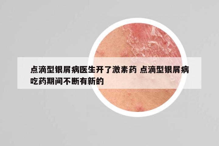 点滴型银屑病医生开了激素药 点滴型银屑病吃药期间不断有新的