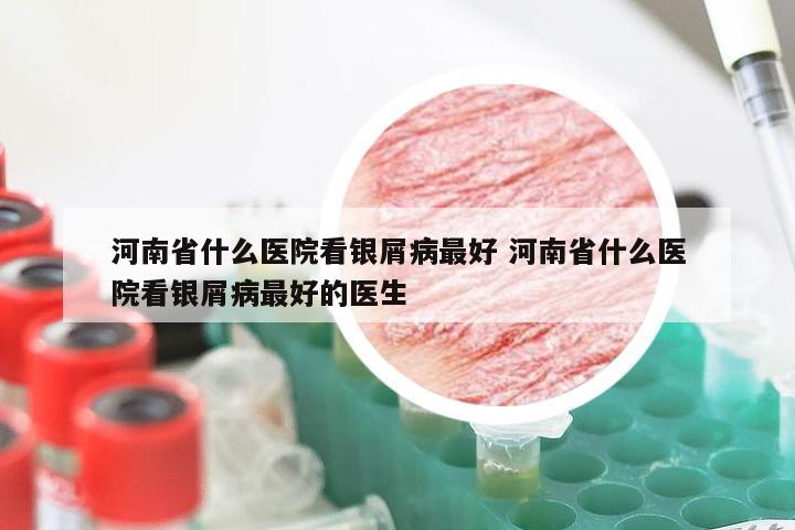 河南省什么医院看银屑病最好 河南省什么医院看银屑病最好的医生