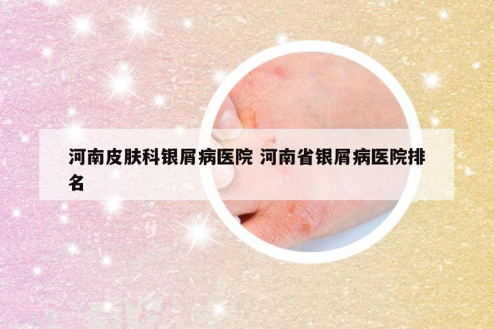 河南皮肤科银屑病医院 河南省银屑病医院排名