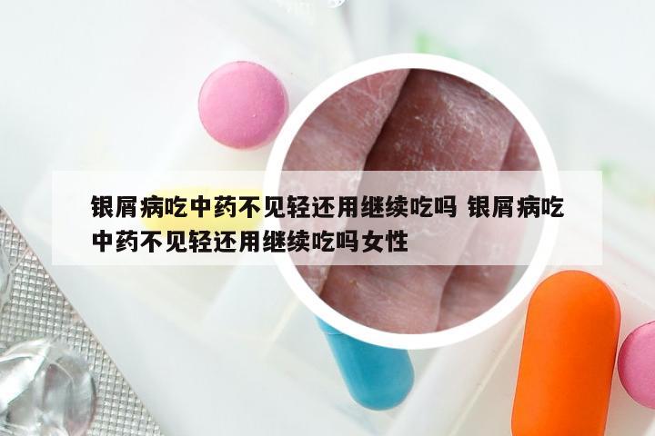 银屑病吃中药不见轻还用继续吃吗 银屑病吃中药不见轻还用继续吃吗女性