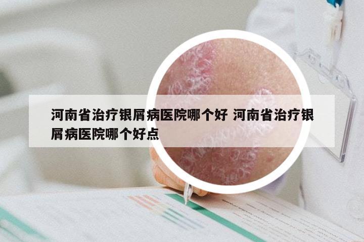 河南省治疗银屑病医院哪个好 河南省治疗银屑病医院哪个好点