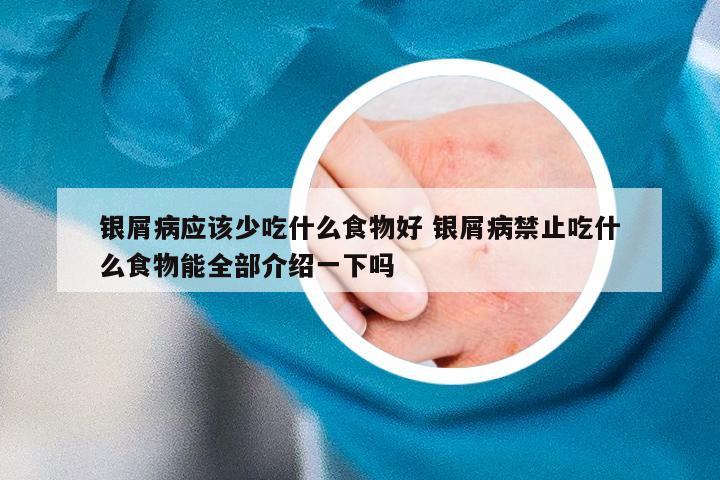 银屑病应该少吃什么食物好 银屑病禁止吃什么食物能全部介绍一下吗