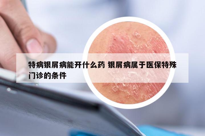 特病银屑病能开什么药 银屑病属于医保特殊门诊的条件