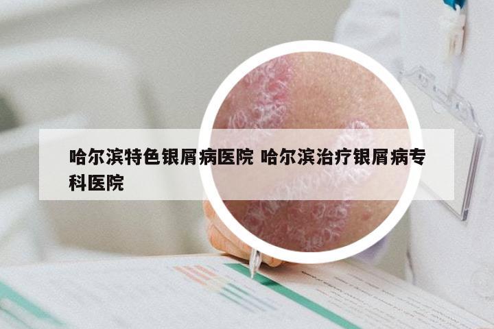 哈尔滨特色银屑病医院 哈尔滨治疗银屑病专科医院