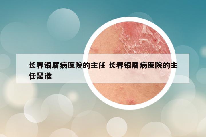 长春银屑病医院的主任 长春银屑病医院的主任是谁