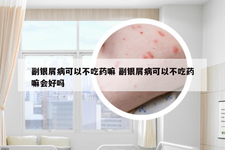 副银屑病可以不吃药嘛 副银屑病可以不吃药嘛会好吗