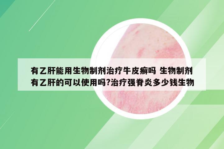 有乙肝能用生物制剂治疗牛皮癣吗 生物制剂有乙肝的可以使用吗?治疗强脊炎多少钱生物