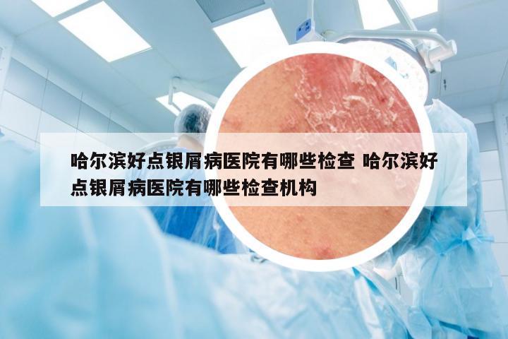 哈尔滨好点银屑病医院有哪些检查 哈尔滨好点银屑病医院有哪些检查机构