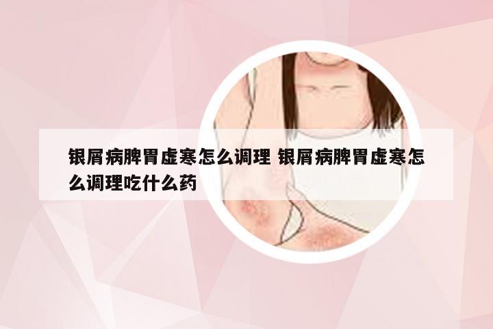 银屑病脾胃虚寒怎么调理 银屑病脾胃虚寒怎么调理吃什么药