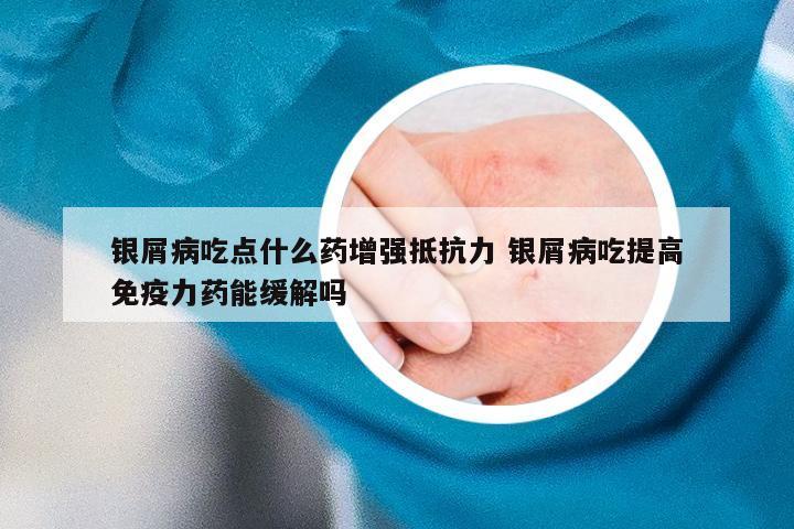 银屑病吃点什么药增强抵抗力 银屑病吃提高免疫力药能缓解吗