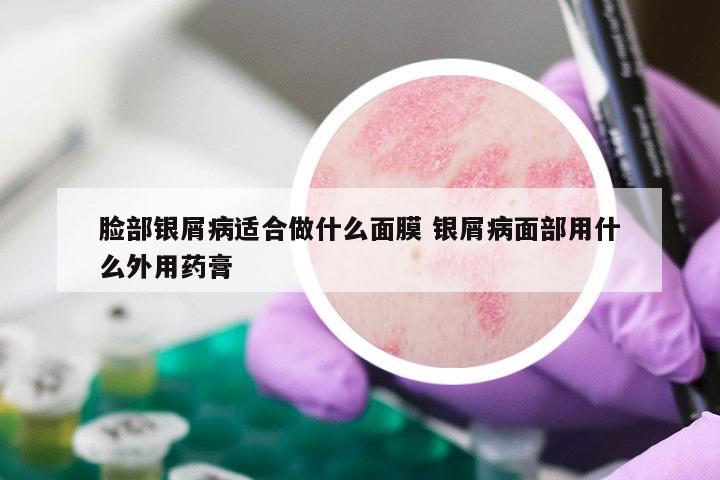 脸部银屑病适合做什么面膜 银屑病面部用什么外用药膏