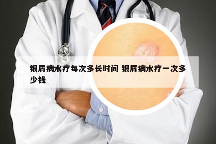 银屑病水疗每次多长时间 银屑病水疗一次多少钱