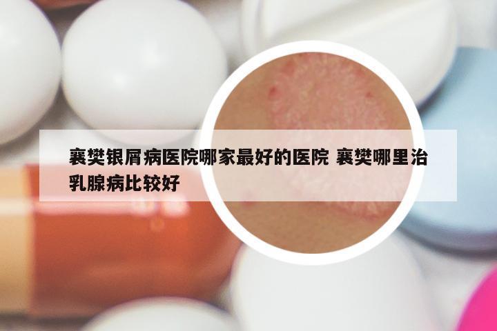 襄樊银屑病医院哪家最好的医院 襄樊哪里治乳腺病比较好