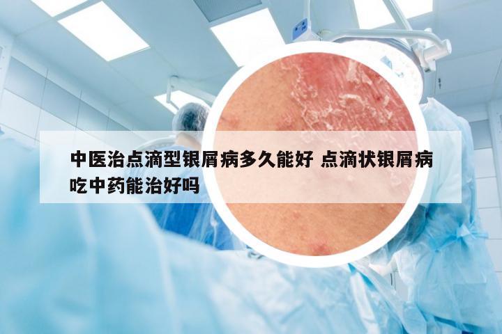 中医治点滴型银屑病多久能好 点滴状银屑病吃中药能治好吗