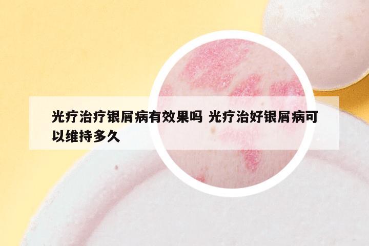 光疗治疗银屑病有效果吗 光疗治好银屑病可以维持多久