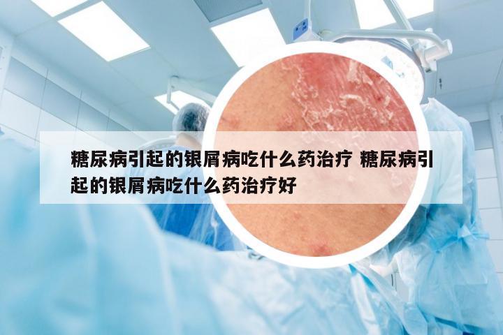 糖尿病引起的银屑病吃什么药治疗 糖尿病引起的银屑病吃什么药治疗好