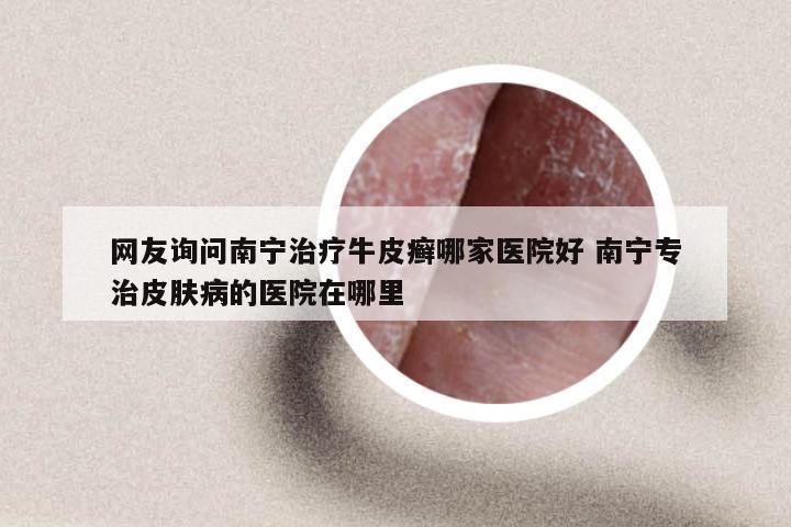 网友询问南宁治疗牛皮癣哪家医院好 南宁专治皮肤病的医院在哪里