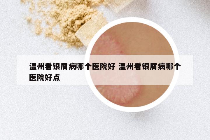 温州看银屑病哪个医院好 温州看银屑病哪个医院好点